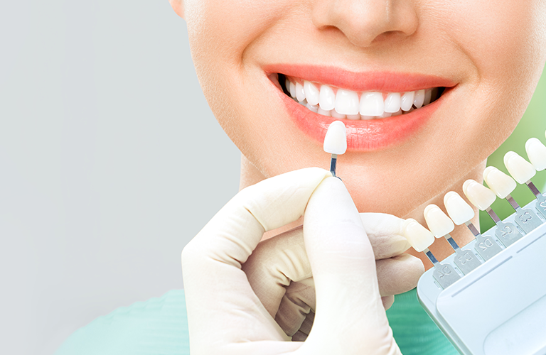 Comparison showing teeth before and after whitening